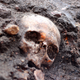 Archeologists begin the main excavation of the Bedlam burial ground.